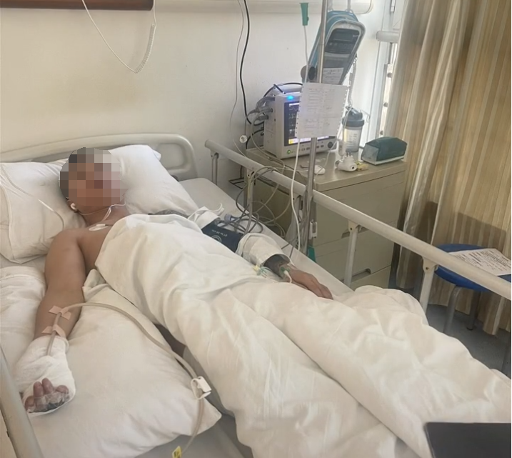 贵州小伙手指不断腐烂面临截肢,只因上班时误触检测仪器的辐射源(图2)