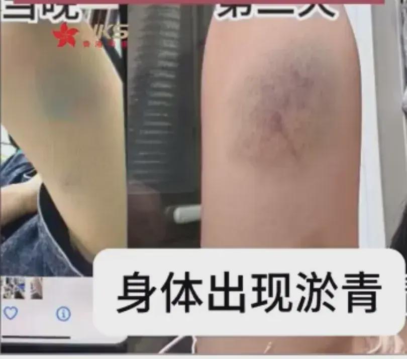 电梯内众人说笑 女生一句吵死引冲突，口吐‬飞沫‬还‬要赔偿‬？(图1)