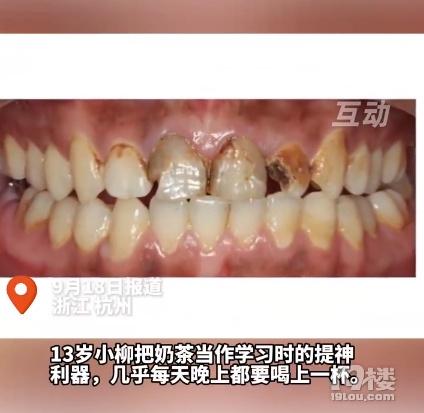杭州13岁女生烂了12颗牙!妈妈大吃一惊:每次都选三分糖,不甜啊(图1)