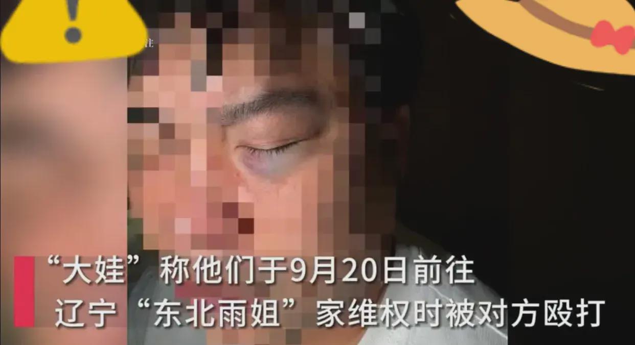 博主“大娃”称上门打假“东北雨姐”时遭殴打,辽宁当地市监局回应(图1)