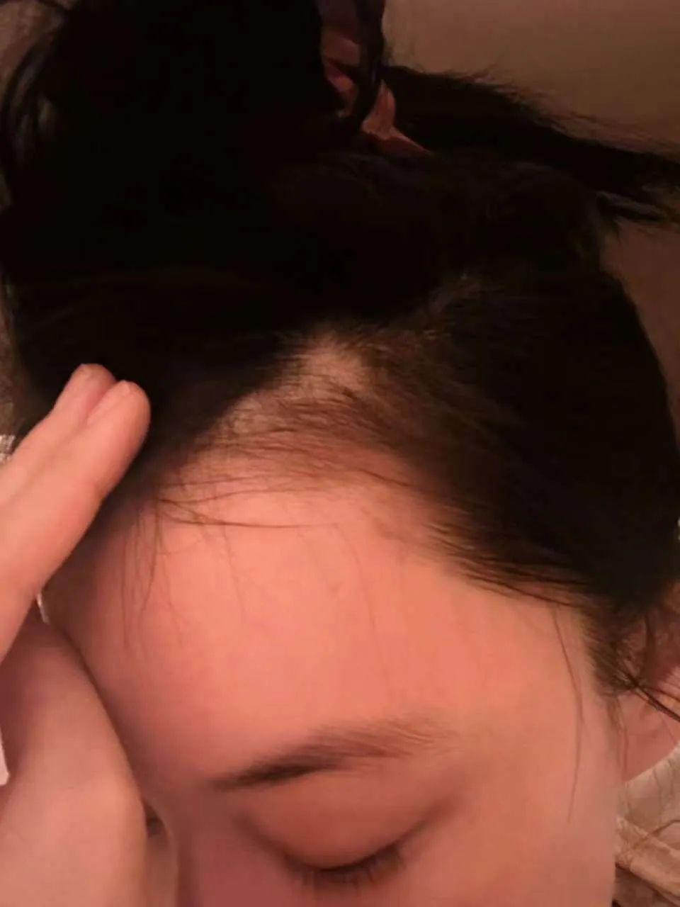 张馨予消失的头发回来了,网友直呼神奇,跪求教程!(图2)