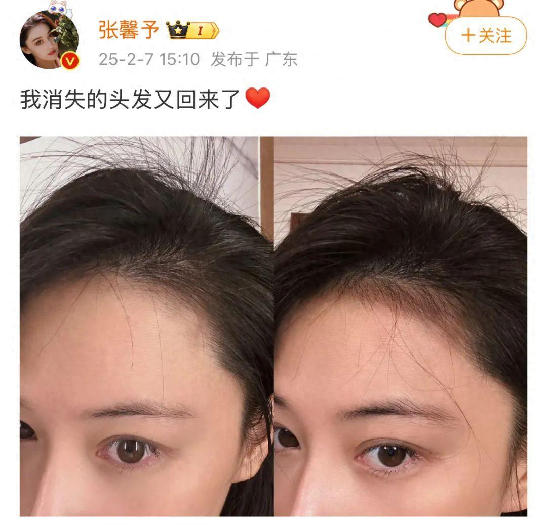 张馨予消失的头发回来了,网友直呼神奇,跪求教程!(图1)